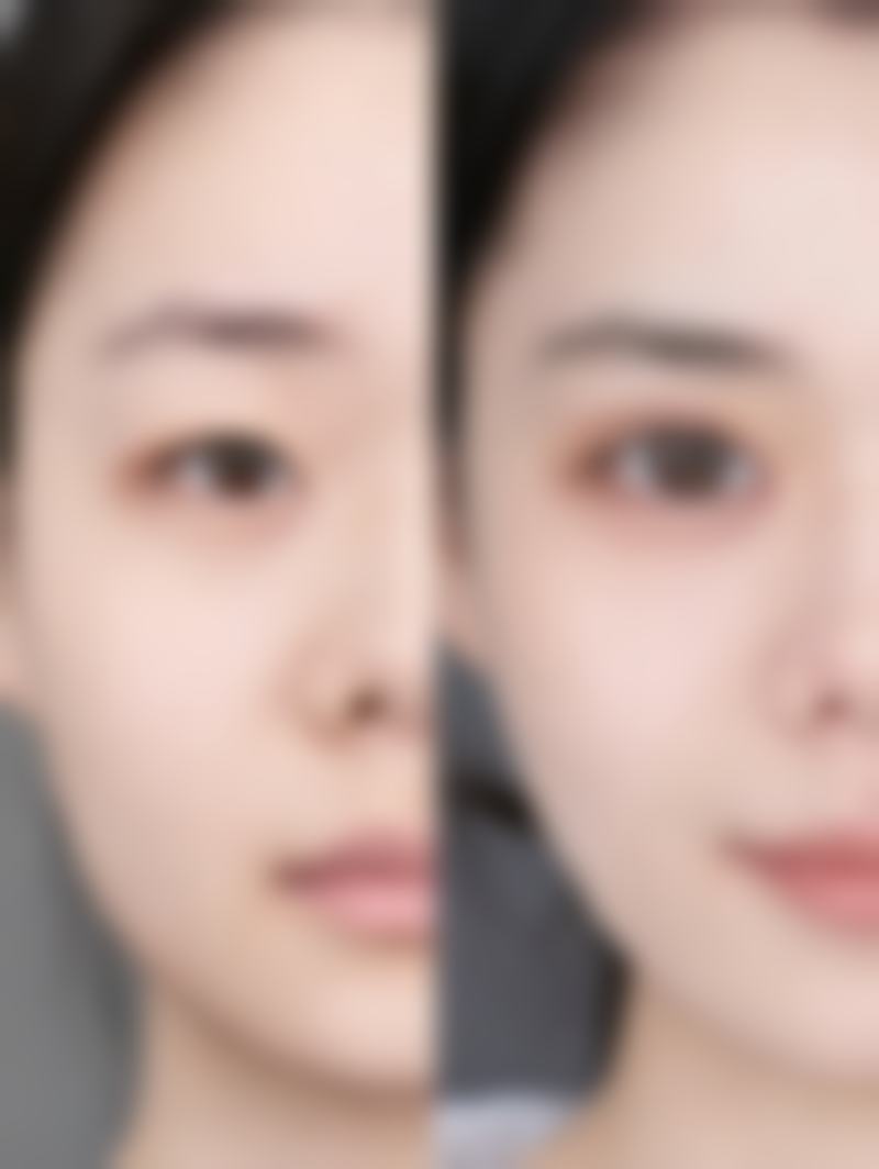 画美张沙沙在线咨询：张医生眼部整形口碑咋样？项目、价格、预约攻略看这里！ 