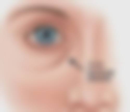 不同脱发状况，都能种植头发么？