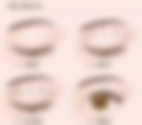 局部凹陷：抽脂不均的直接体现