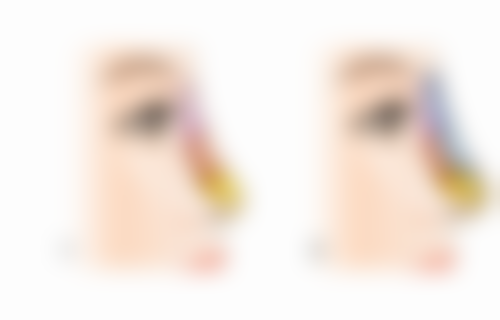 治疗注意事项:让治疗成效更理想