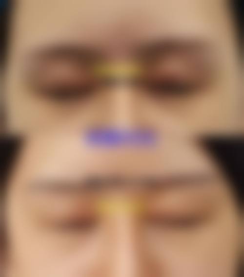 重庆如花医疗美容整形收费价格表/收费标准