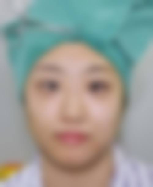 天津曦和整形医院收费价格表/收费标准