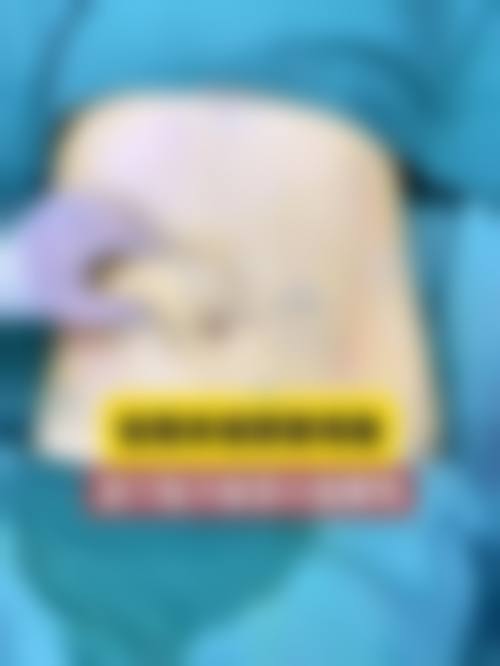 重庆如花医疗美容整形真人口碑评价怎么样?