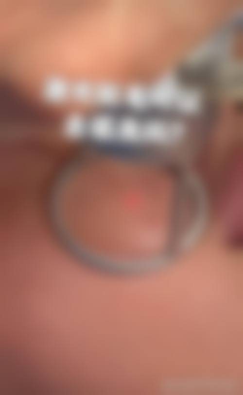 湖北省中医院医学美容科真人口碑评价怎么样？