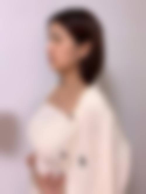 长春瑞希整形医院真人口碑评价怎么样？