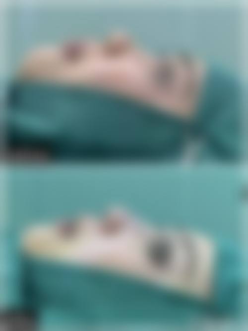 眉山蝶儿整形医院详细的预约挂号方式及流程