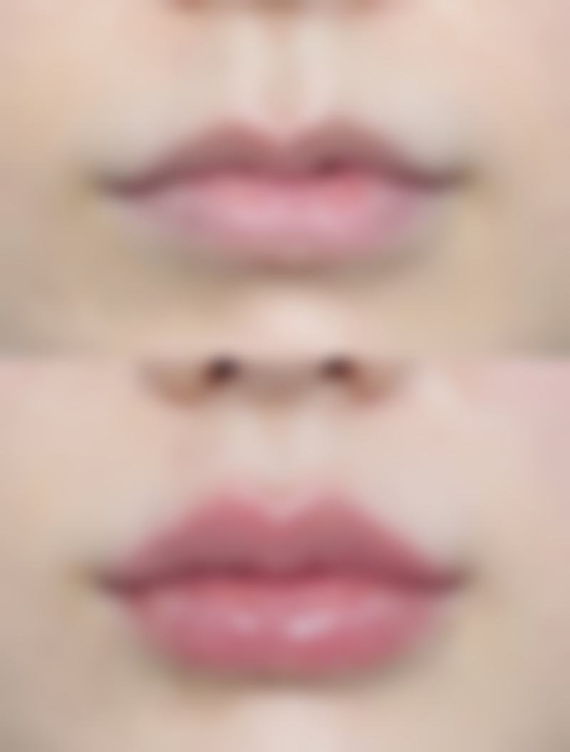 蚌埠欣悦整形医疗美容真人口碑评价怎么样?