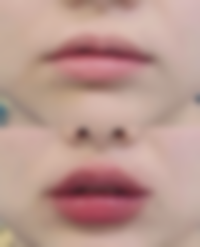 病理性因素:疾病引发的眼皮异常