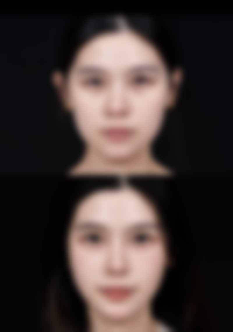 药物治疗有门道，合理选择特别重要