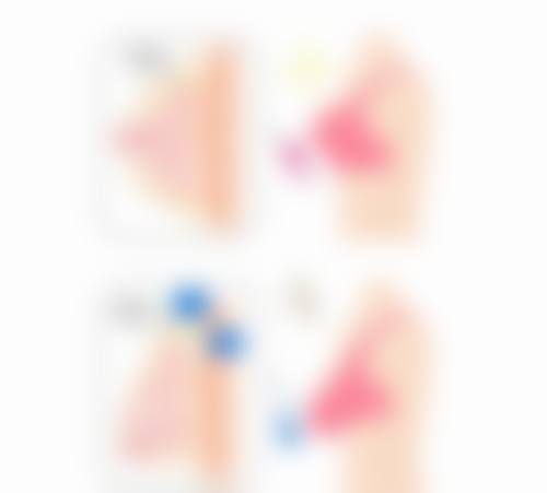 术前全方面检查与准备不可少