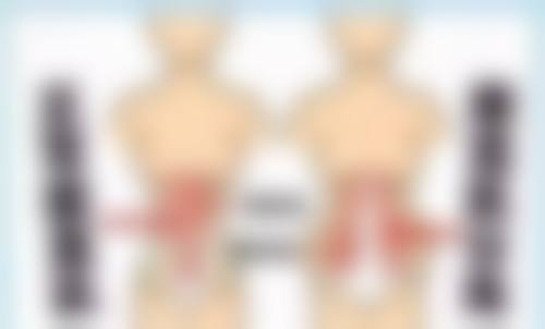 术后护理情况:加快或延缓淤青修复的后天因素