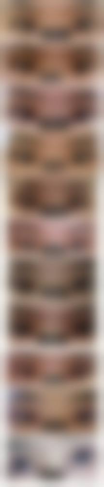 黑龙江哈尔滨艺星整形美容医院真人口碑评价怎么样？