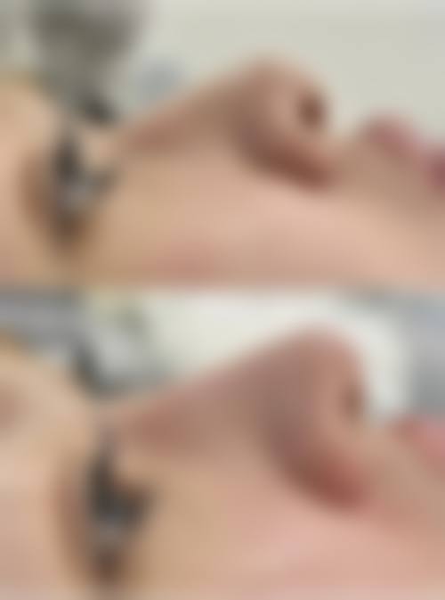 银川市田永成整形美容医院真人口碑评价怎么样？