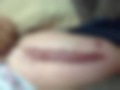 重庆杨东运怎么样？就职东上医美，LBD减张缝合技术佳，患者满意度超4.8分！ 