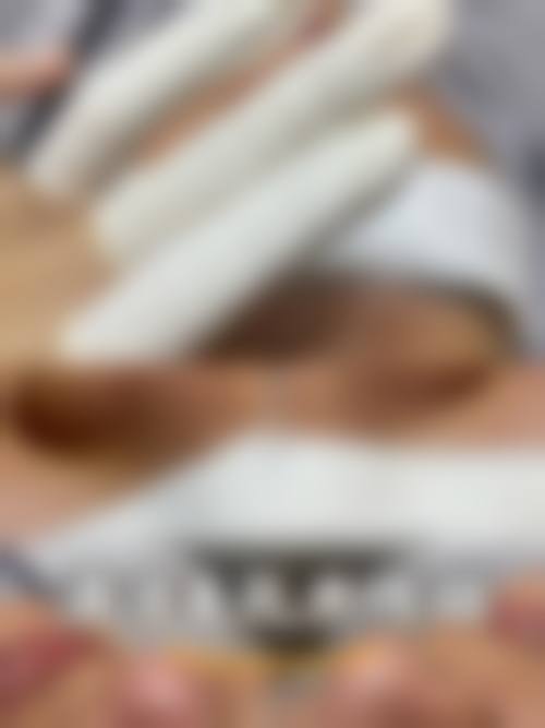 灌南陈佳医疗美容诊所真人口碑评价怎么样？