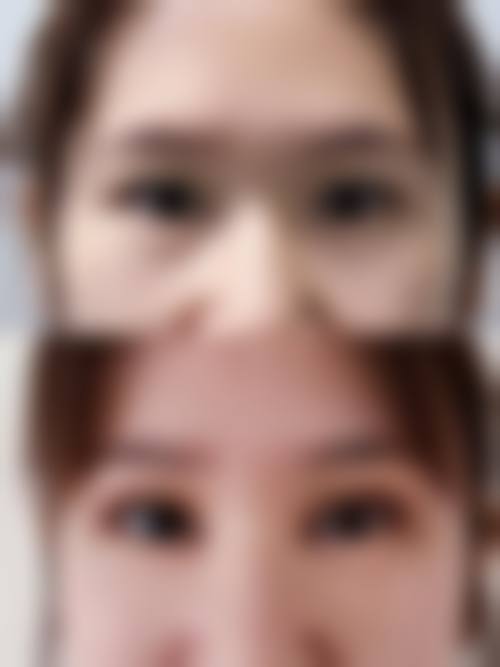 泰国清迈lannawadee兰纳瓦德整形外科真人口碑评价怎么样？