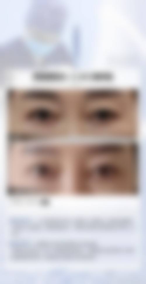 深圳市第二人民医院整形烧伤科真人口碑评价怎么样?