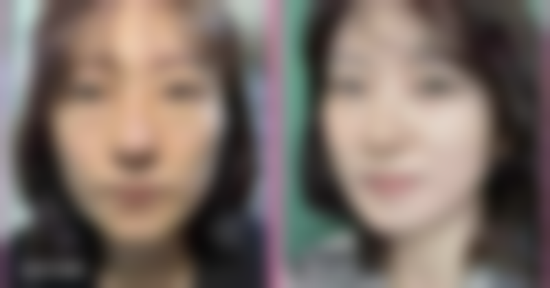 疤痕妊娠药流存在的高风险