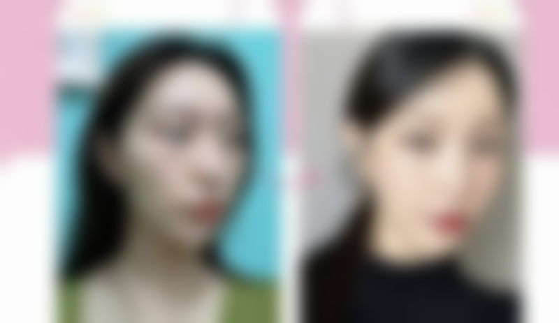 特殊情况:淤青修复异常的应对措施