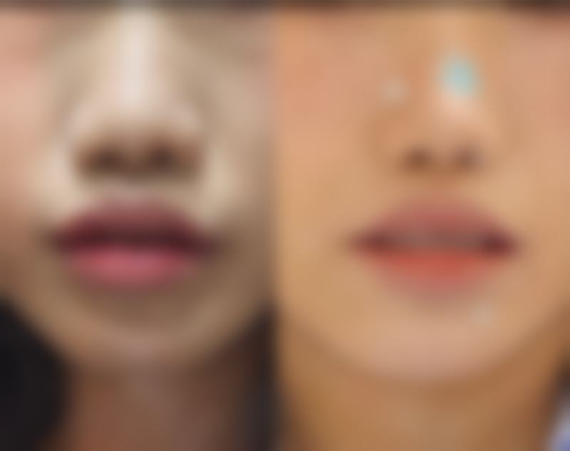 ELEV皮肤科：分层抗衰细节控