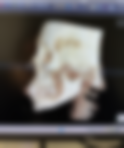 手术方式：不同方法对下垂的影响差异