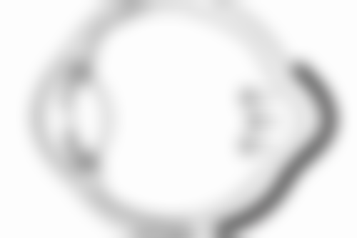 激光治疗：精细改善烧伤疤痕外观