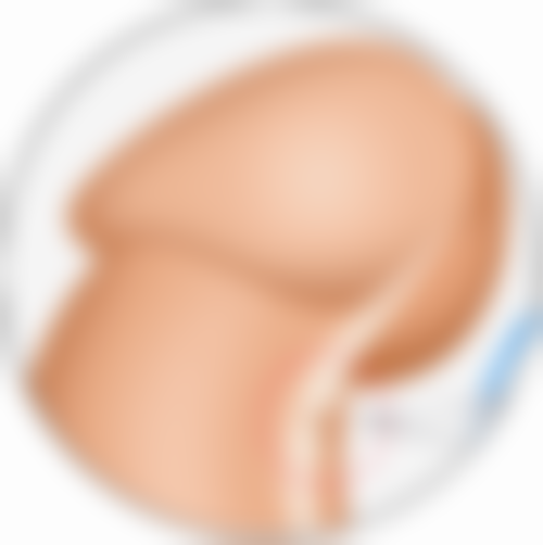 蚊虫叮咬：夏日常见的眼部肿胀原因