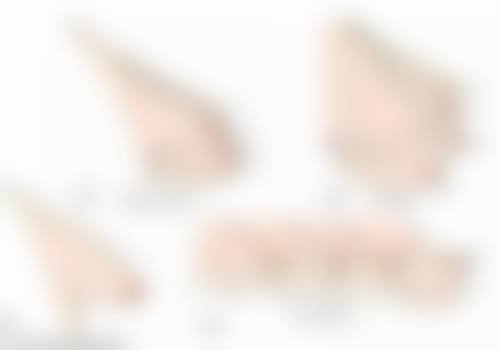 日常护理：悉心呵护，促进疤痕修复