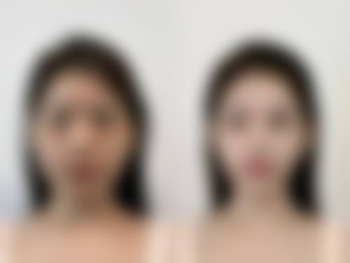 巴彦淖尔李秀芝医疗美容诊所详细的预约挂号方式及流程