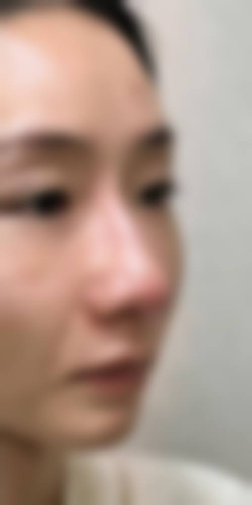 郑州华懿医疗美容门诊部真人口碑评价怎么样？