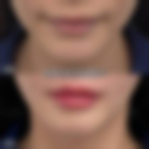 人文关怀：温暖治疗全过程