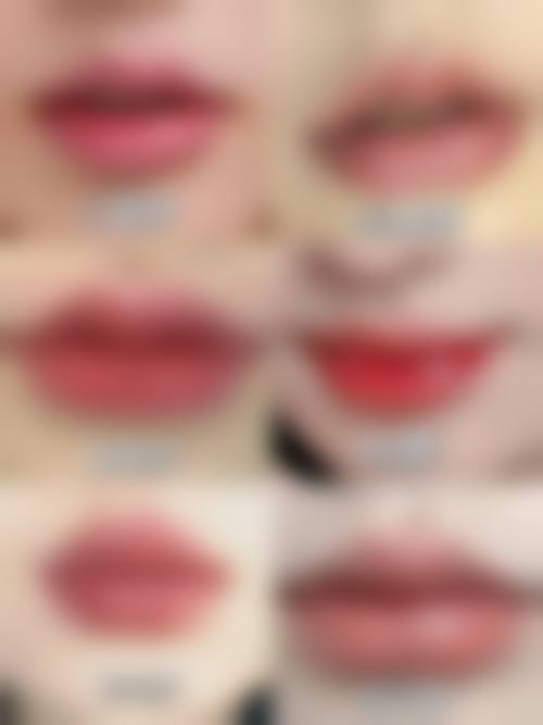 免费手术：减轻经济负担