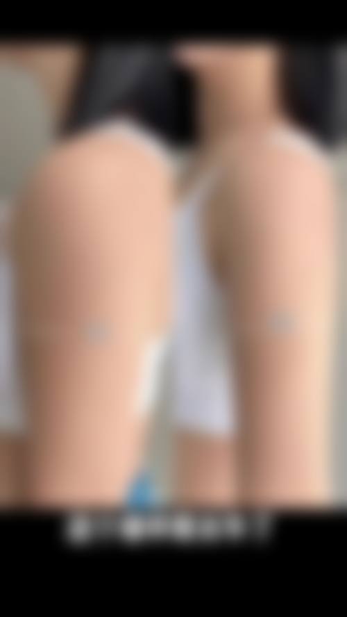 呼和浩特熙美优合医疗美容医院特色项目及技术优势