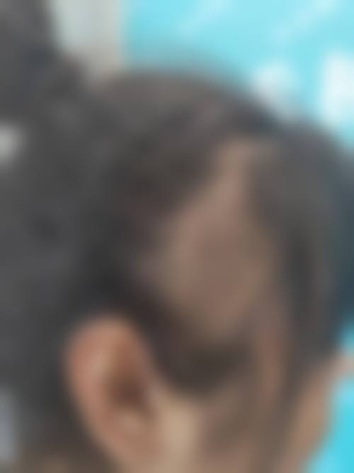 厦门万禾丽生植发诊所地址在哪？思明区长青北里108号103单元，佘晓龙医生技术靠谱！ 