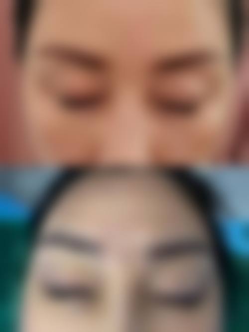 肇庆民和医院激光整形科收费价格表/收费标准