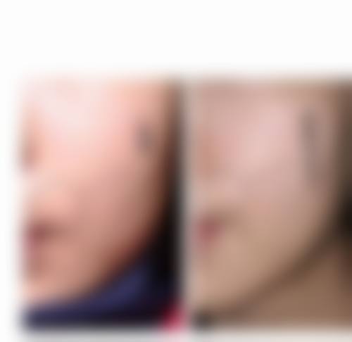 韩国NYPS整形外科医院收费价格表/收费标准