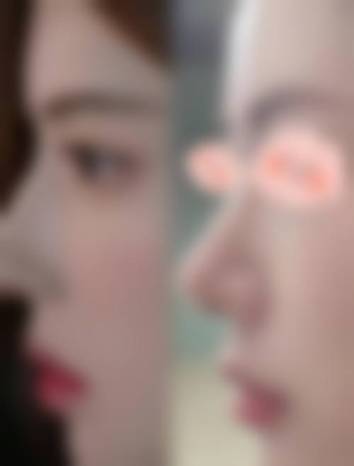 廊坊塑颜整形医院真人口碑评价怎么样？