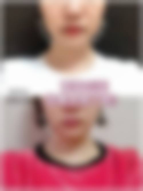 淮安仁爱整形医院收费价格表/收费标准