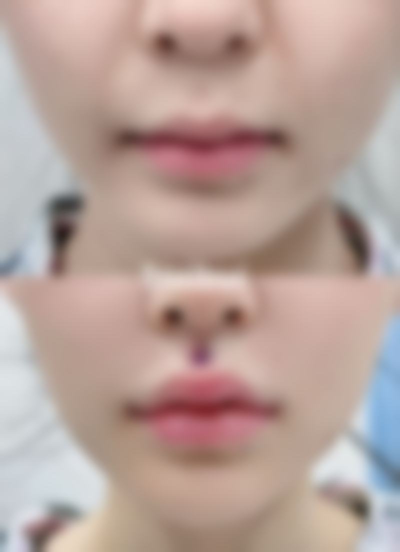 郑州华懿医疗美容门诊部地址电话营业时间