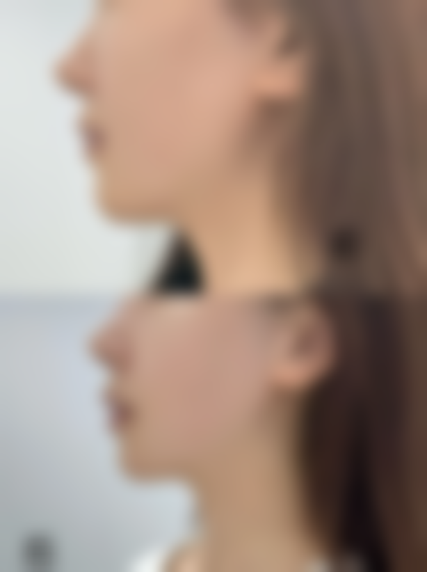 药物治疗：简单有效的祛疤基础方式