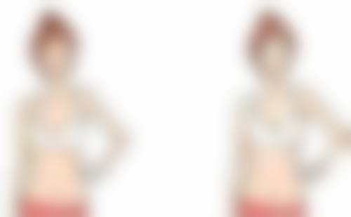 周志杰医生口碑评价及真人实例