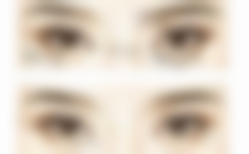 梅蔚德医生口碑评价及真人实例