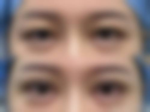 TeerasakPhadayakul医生口碑评价及真人实例