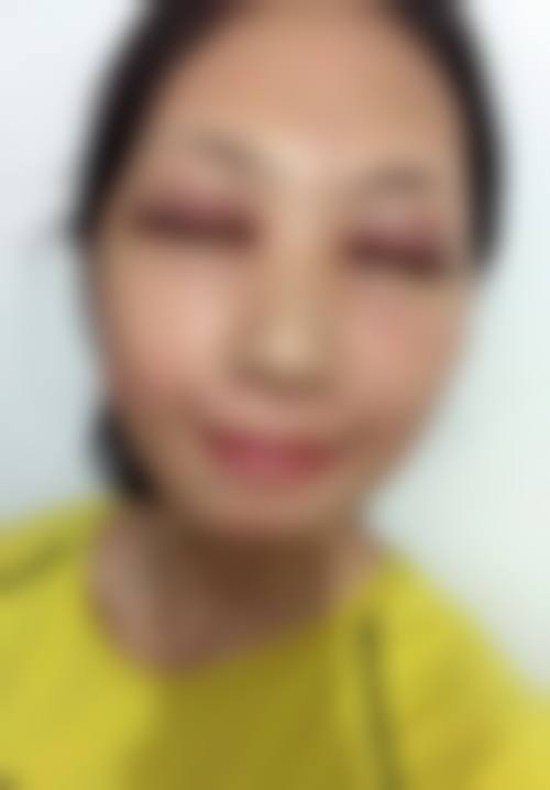 北京AJ医疗美容诊所真人口碑评价怎么样?