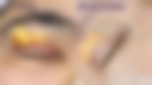 严国捷医生口碑评价及真人实例