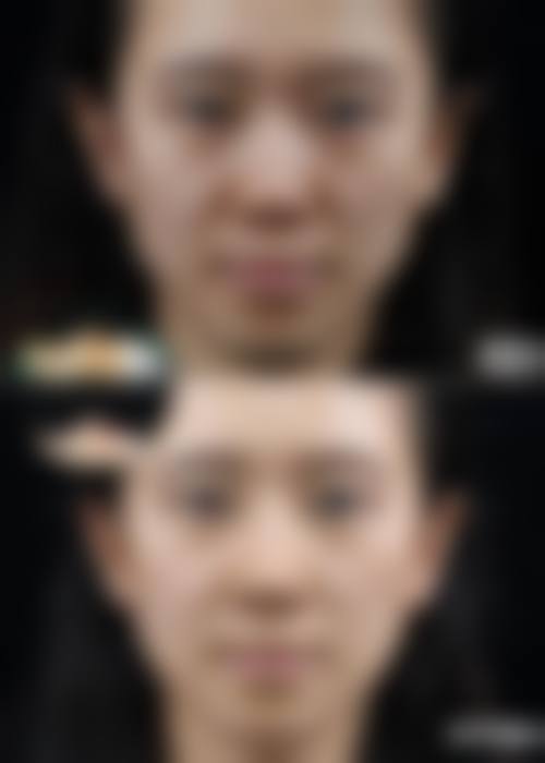 乌鲁木齐张瑞红整形医疗美容诊所收费价格表/收费标准