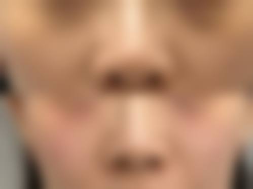 江西抚州薇琳整形真人口碑评价怎么样？