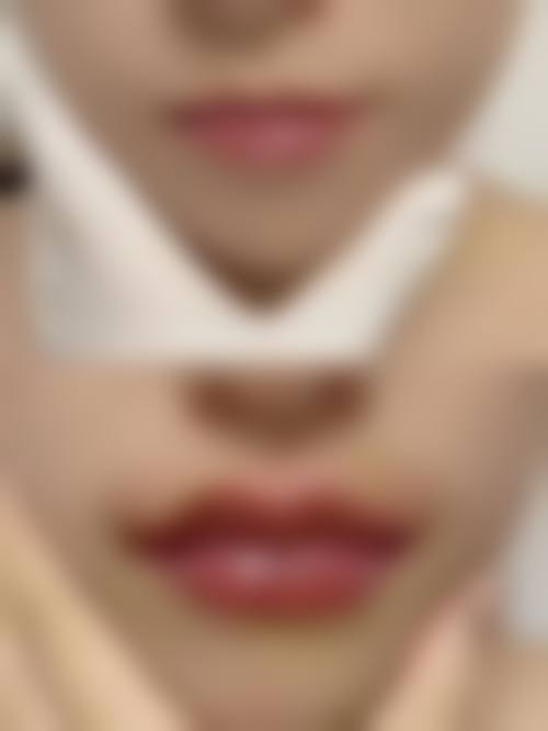 乌鲁木齐张瑞红整形医疗美容诊所详细的预约挂号方式及流程