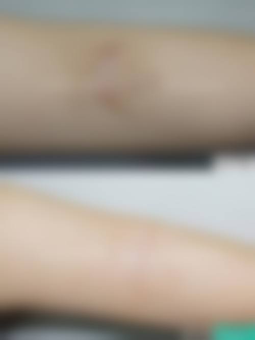 张琴真医生价格表