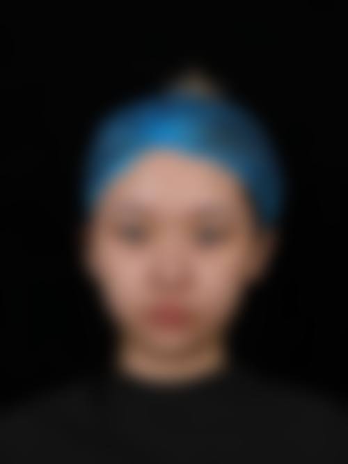 乌鲁木齐张瑞红整形医疗美容诊所真人口碑评价怎么样？